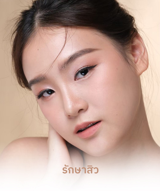 รักษาสิว